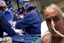 Photo of CIÊNCIA: Coração de porco é transplantado para um humano com sucesso