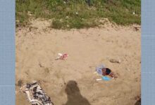 Photo of Jovem dormiu em praia e acorda com a barriga cortada e parte do intestino pra fora