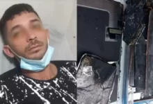 Photo of Celular explode e jovem perde parte da visão