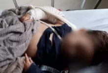 Photo of Professora é acusada de quebrar braço de criança em creche no Paraná