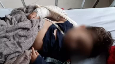 Photo of Professora é acusada de quebrar braço de criança em creche no Paraná