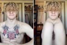 Photo of Rapaz sem clavículas usa ombros para ‘bater palmas’ e viraliza no TikTok
