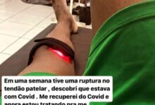 Photo of Atacante Joãozinho é a primeira baixa no elenco do Concórdia