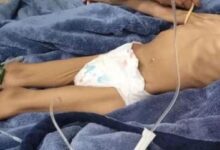 Photo of Homem é preso por deixar a filha de 3 anos sem comer por 40 dias