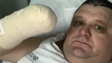 Photo of Humorista “Pilha” perde a mão após estourar foguete no Oeste de SC