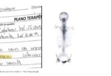 Photo of Por erro médico, mulher trata câncer inexistente durante 6 anos