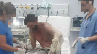 Photo of Trabalhador fica com 45% do corpo queimado ao levar choque em rede de alta tensão