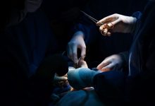 Photo of SC segue batendo recordes de cirurgias e ultrapassa a marca de 900 mil procedimentos
