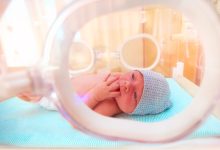 Photo of Lei obriga exame que detecta fissura labiopalatina nas primeiras 48h em recém-nascidos